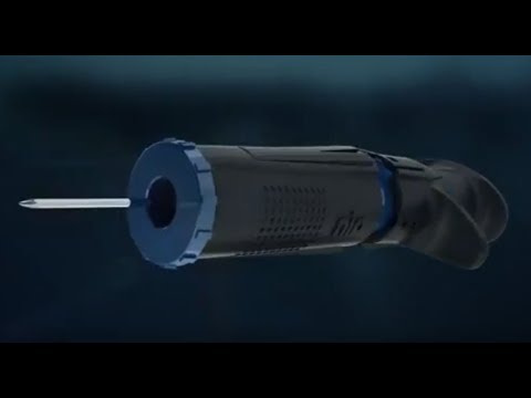 NIO New Intraosseous Device