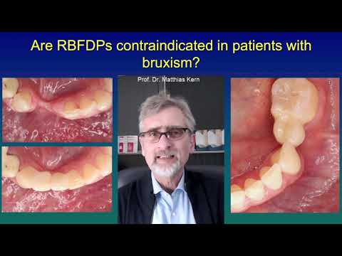 Are RBFDPs contraindicated in patients with bruxism?
