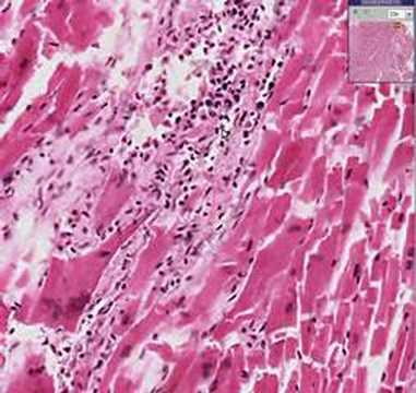 Come eliminare i vermi del bambino Il helminths alla persona dovè