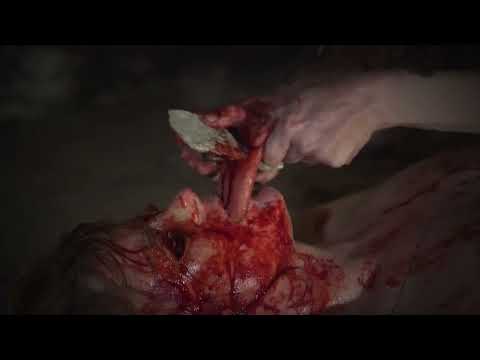 Trailer ROMANCE POST-MORTEM - TEASER - EXTREME!!!