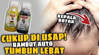 Download lagu WAJIB IKUTI! Cara Pemakaian Minyak Kemiri Al Khodry Agar Rambut Tumbuh Lebat Dengan Waktu Yang Cepat mp3 Download lagu WAJIB IKUTI! Cara Pemakaian Minyak Kemiri Al Khodry Agar Rambut Tumbuh Lebat Dengan Waktu Yang Cepat mp3