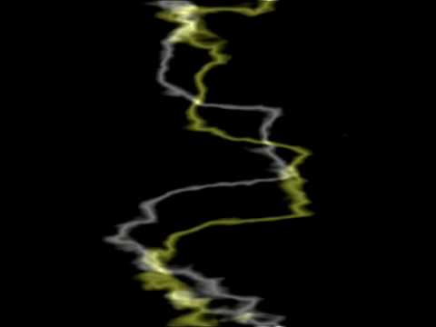 KarolaJ Feat. DieeS - Membrana Napierdala(mix Nestor)