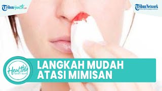 Langkah Mudah Atasi Mimisan yang Sering Terjadi, Kenali Penyebab sejak Dini agar Tak Pendarahan