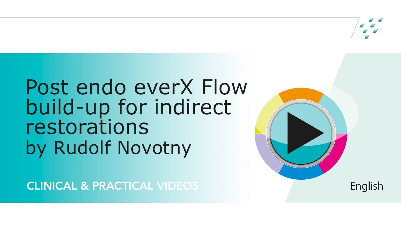 EverX Flow pour restaurations indirectes