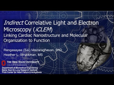 Super Res | Linking Cardiac Nanostructure and Molecular Organization to Cardiac Function | Bruker