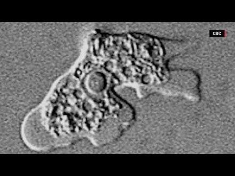 How dangerous are brain eating amoeba?