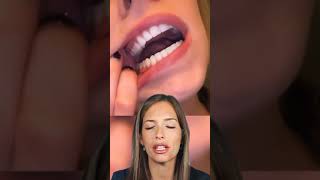 MIRA como es la MORDIDA PERFECTA DE LOS DIENTES - Así verás SI NECESITAS BRACKETS #shorts