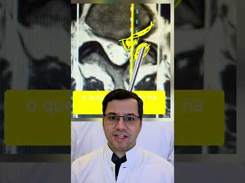 Marco Aurélio Severo Da Silva Versiani-106