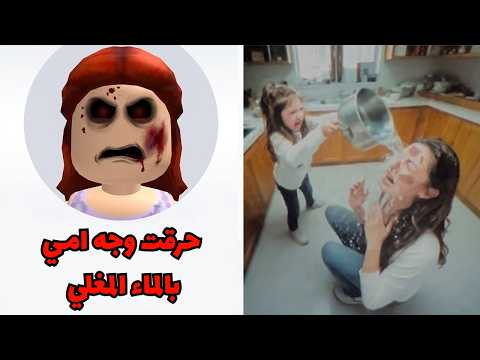 قصة لاعبة روبلوكس الي رمت ماء مغلي على وجه أمها!