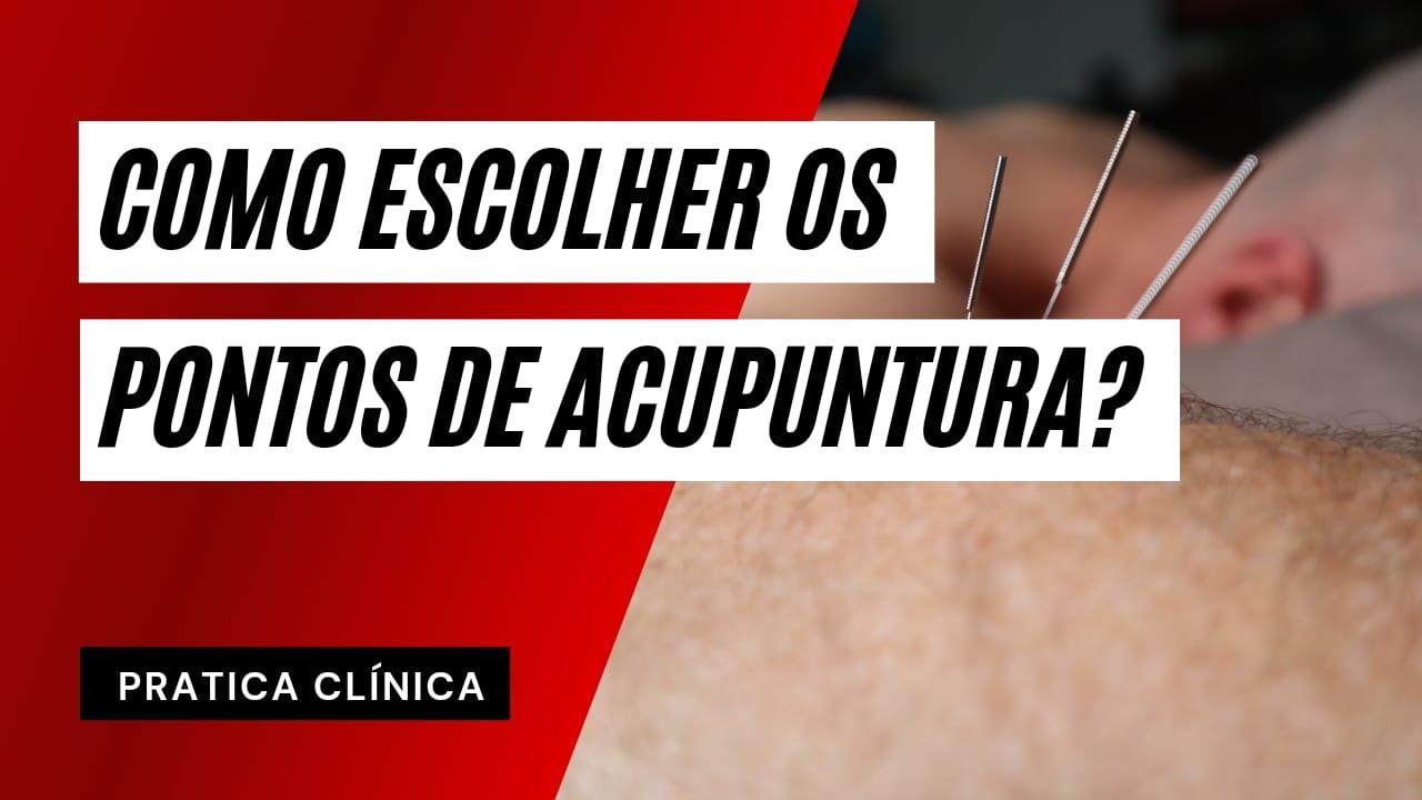 Como escolher os melhores pontos de acupuntura?