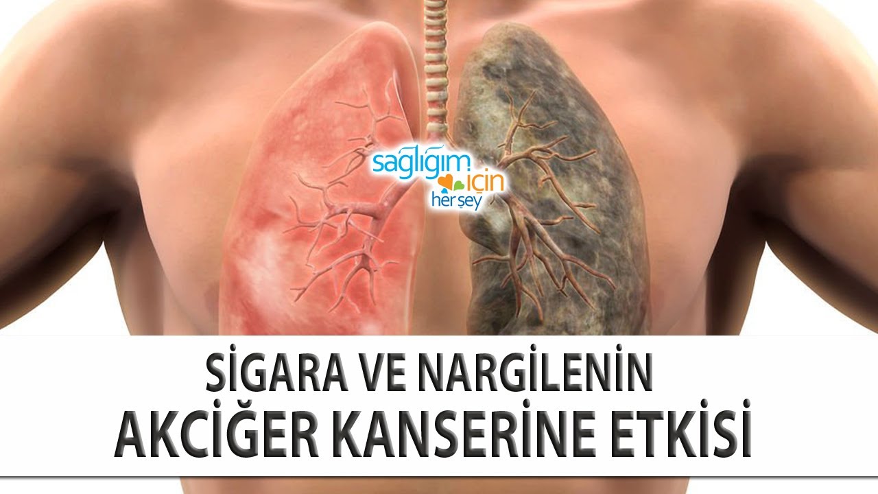 Sigara İçenlerde Akciğer Kanseri Olma Riski Nedir?