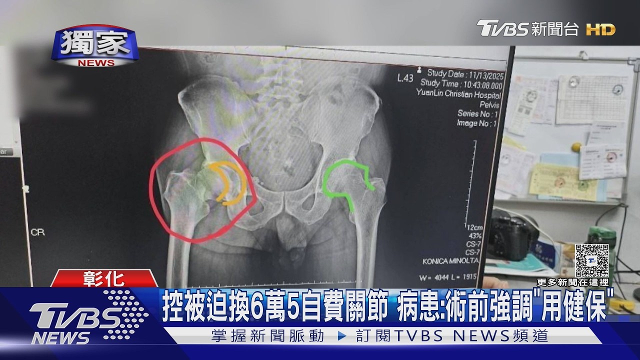 獨家影音/女兒當面撤自費項目!父仍被裝陶瓷關節 家屬怒:監視器都有錄