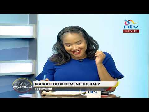 Understanding maggot debridement therapy in Kenya | Your World