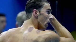 Cupping - How Does It Work
