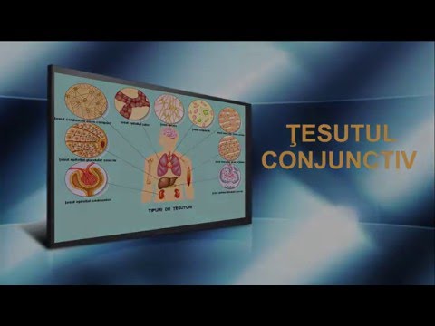 Ureaplasmoza și micoplasmoza - Viermi, Inflamația ureaplasmozei articulare