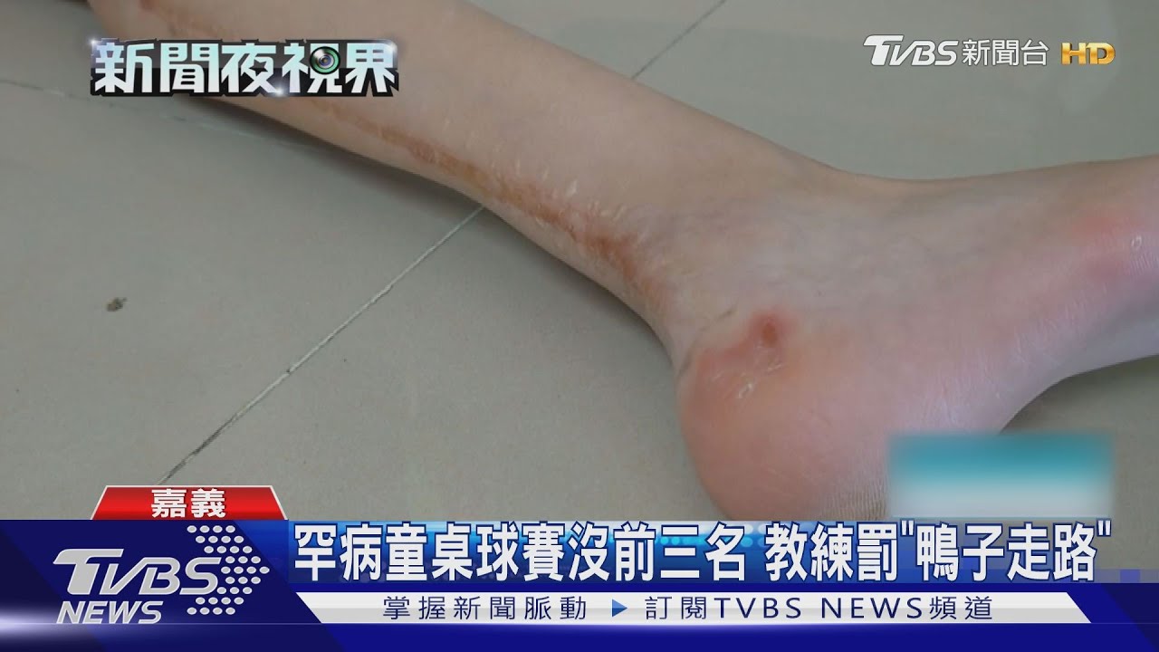 罕病童桌球賽沒前三名　教練罰「鴨子走路」