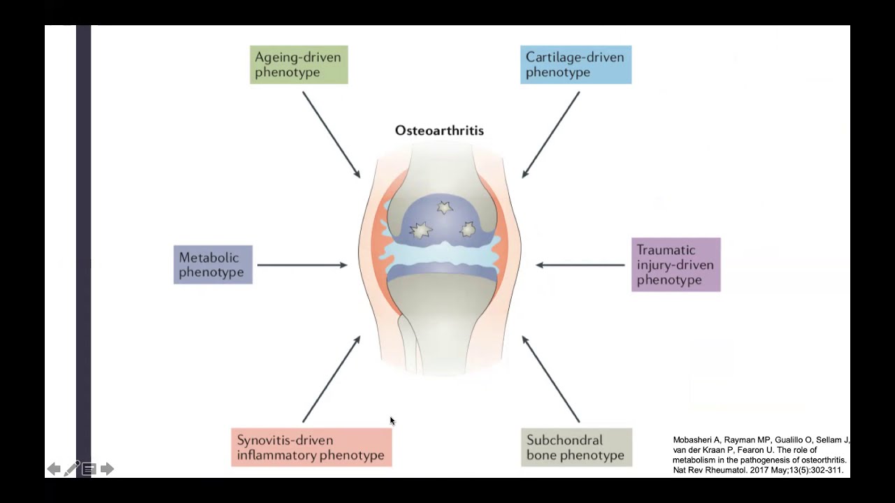 Fisiopatología de la Osteoartritis (Dra. Thalia Sotelo)