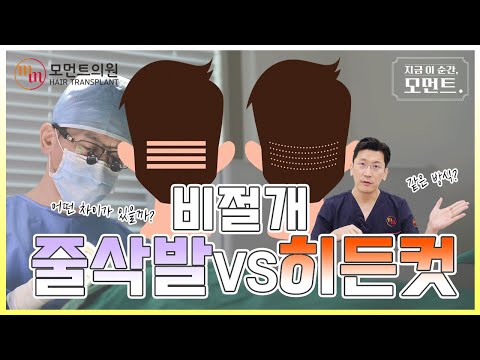 줄삭발 VS 비절개 히든컷 어떤 차이가 있을까? (무삭발모발이식) l 김경복원장 l 모먼트의원(MOMENT)