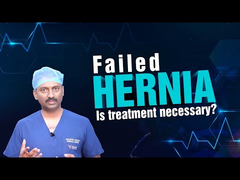 Failed Hernia - Is Treatment Necessary? | Dr Parthasarathy