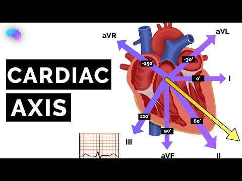 Cardiac Axis Explained | ECG | EKG | OSCE Guide | UKMLA | CPSA | PLAB 2