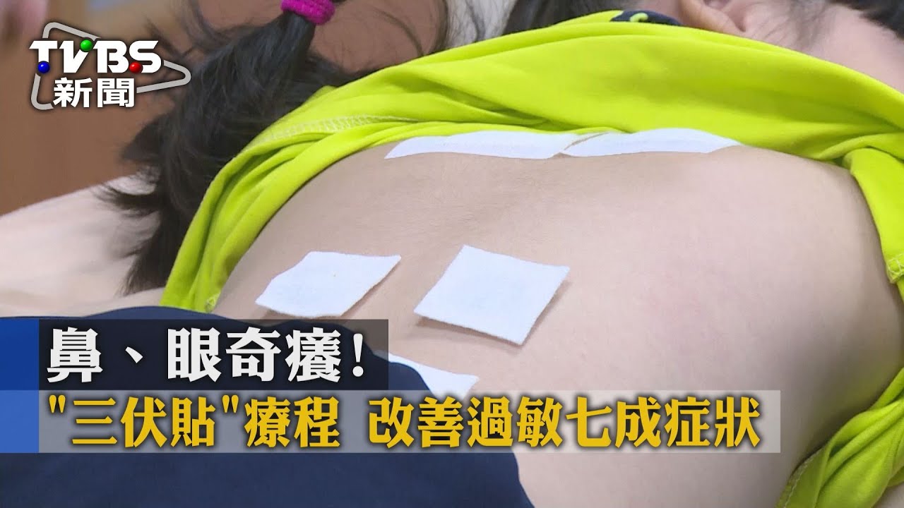 鼻、眼奇癢!「三伏貼」療程 改善過敏七成症狀