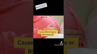 Download lagu Side effects of Tramadol 💊|#tramadol #medicine #sideeffects #doctorshorts #reels #painkiller #tips mp3