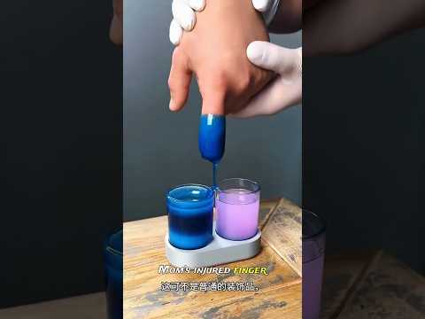 🔥 Dad Built a Genius Gadget for Mom’s Injured Finger! 😱❤️ #shorts #shortsfeed