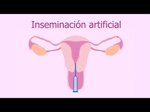 La inseminación artificial (IA): ¿Qué es y cuál es su precio?