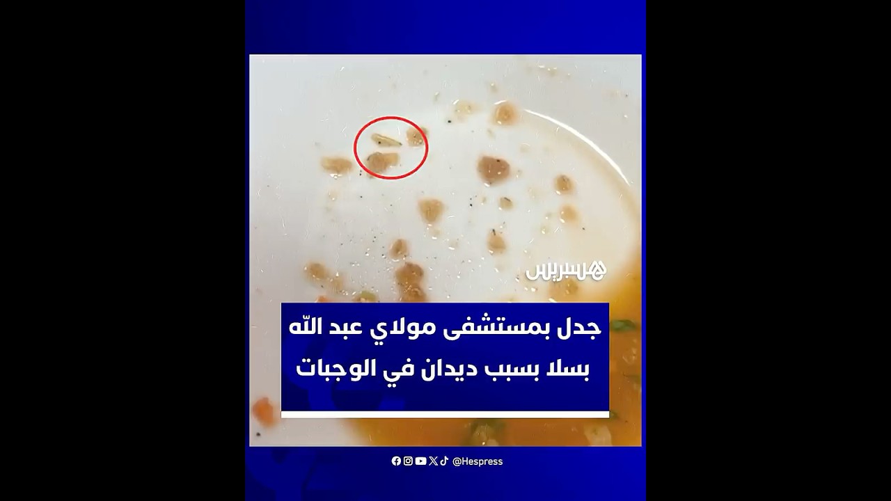 جدل في مستشفى مولاي عبد الله بسبب فيديو يظهر "ديدانا" في وجبات المرضى thumbnail
