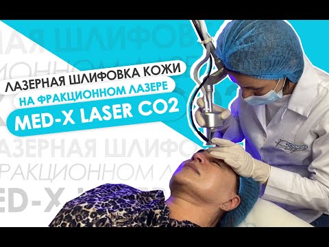 Фракционный лазер MED-X Laser CO2 с RF-модулем - видео