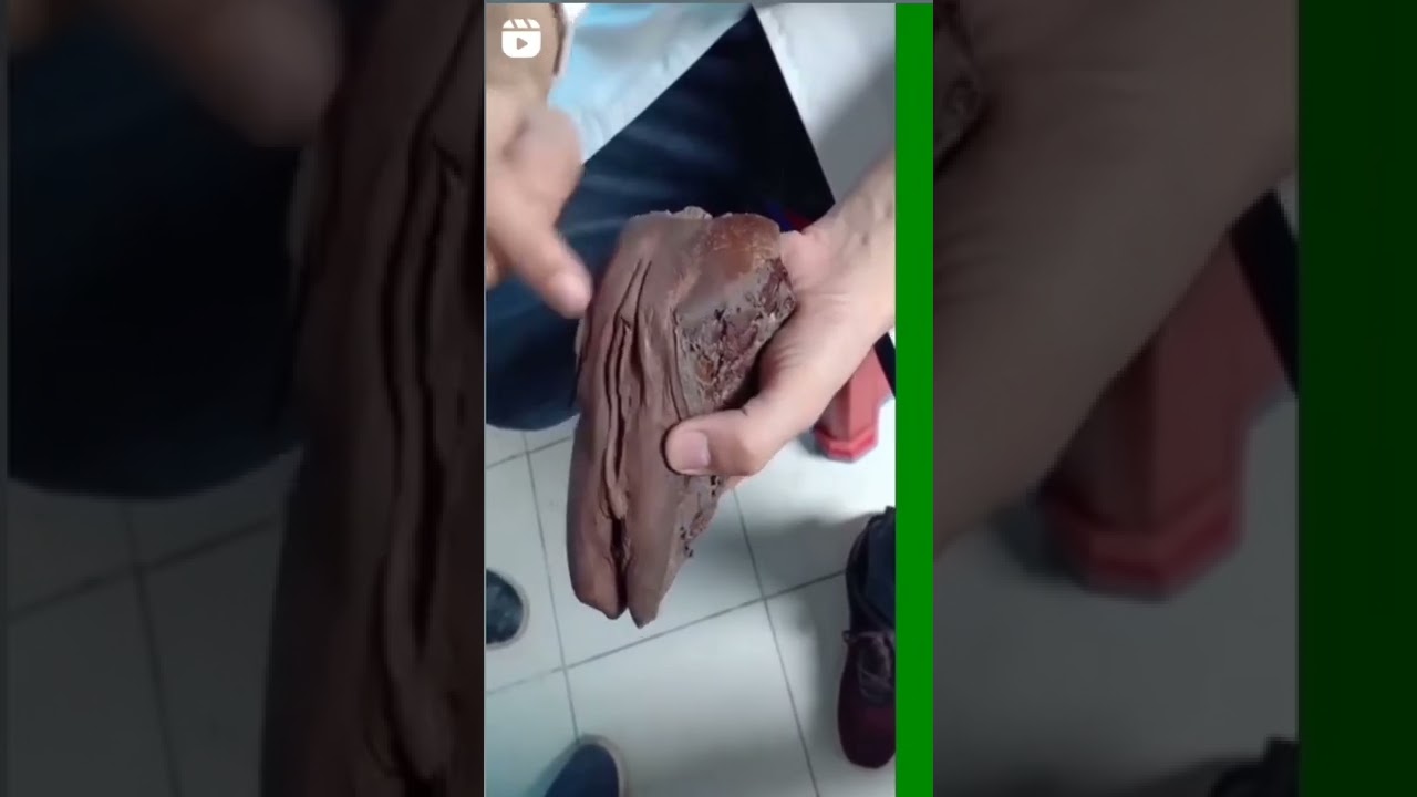 female♀️ reproductive organs | #neet #mbbs #trending 🔥🔥😱😱😱😱😱😱😱😱😱😱😱😱😱😱😱😱