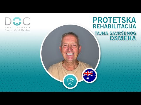 Protetska rehabilitacija - iskustvo pacijenta - Dental Oral Centar