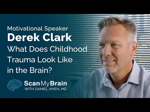 What Does Childhood Trauma Look Like in the Brain? / Scan My Brain x Derek Clark