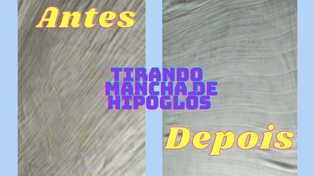 Como tirar mancha de hipoglós da roupa tecidos bebê