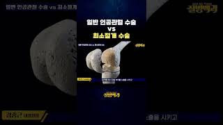 일반 인공관절 수술 vs 최소절개 수술 #shorts