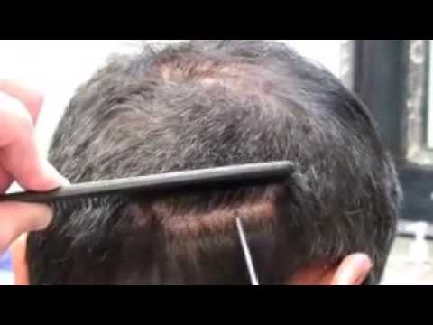Rod's Undetectable Suture