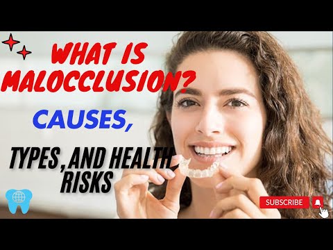 What is Malocclusion? Causes, Types, and Health Risks 🦷