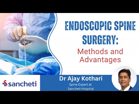 Endoscopic Spine Surgery Explained | Faster Recovery, Less Pain! 