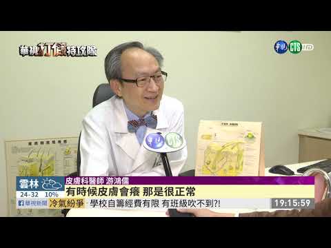 網傳"淋酸雨會掉髮" 醫師破解迷思