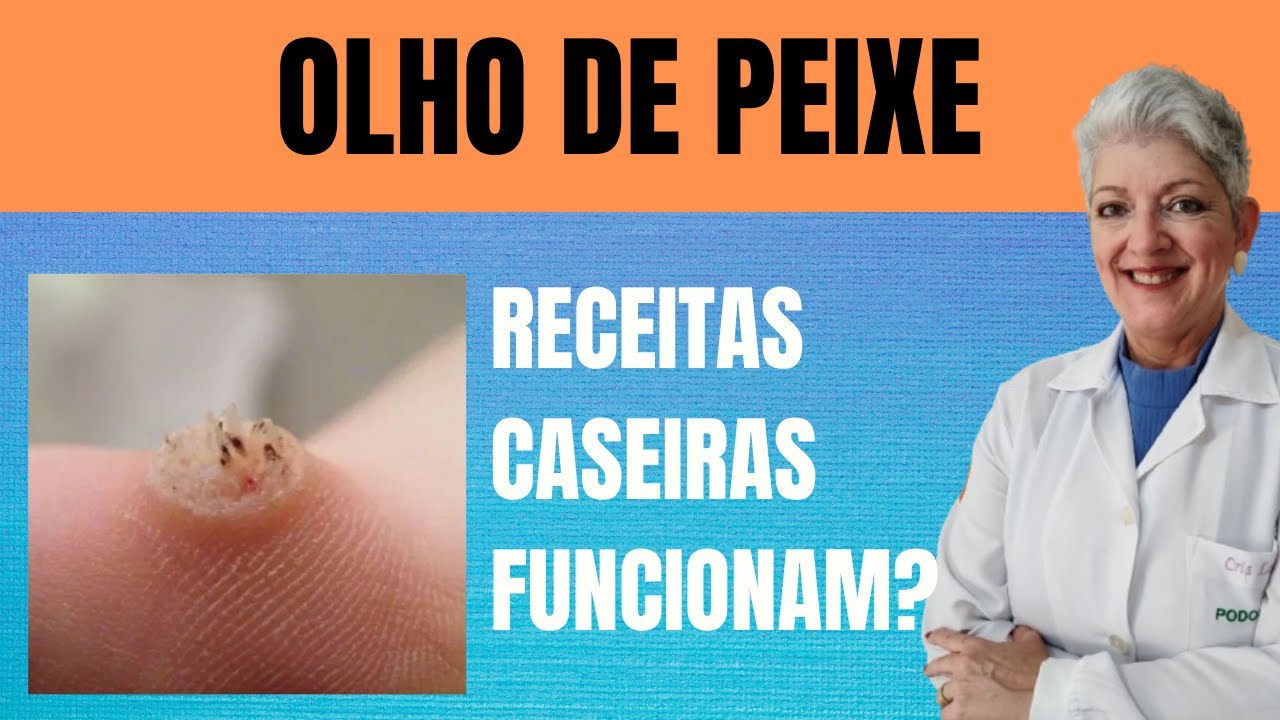 OLHO DE PEIXE Será que Remédios Caseiros Funcionam?