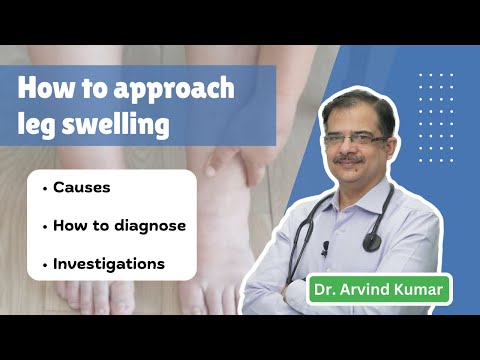 Approach to leg swelling | General practice | Dr Arvind Kumar