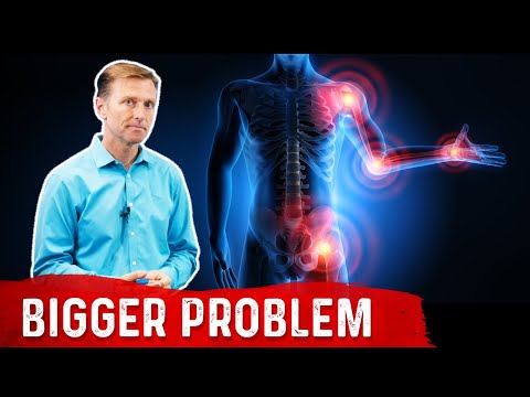 Deeper Causes of Pain Inflammation – Dr Berg
