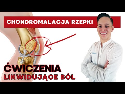 Chondromalacja rzepki ćwiczenia - 4 skuteczne sposoby na ból kolana
