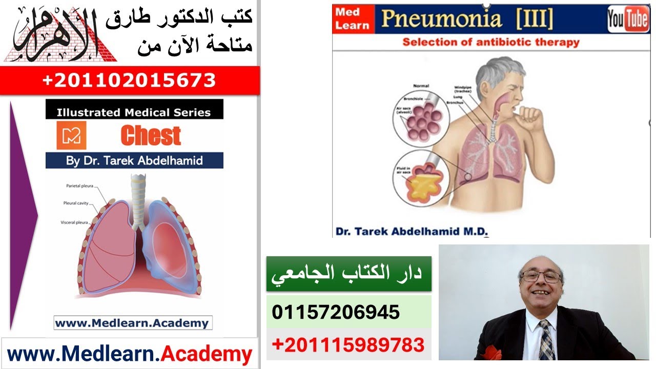 Pneumonia (III)    #cme #internal_medicine #medical #usmle #محاضرات_باطنة