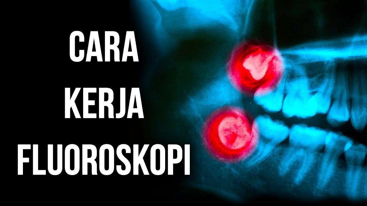 Cara Kerja Fluoroskopi alias Sinar-X