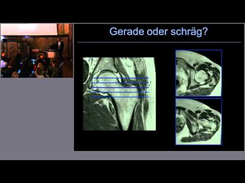 Rückenschmerzen schnell geht Terpentin Salbe Osteochondrose