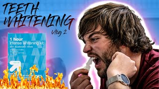 Does teeth whitening work? | Vlog