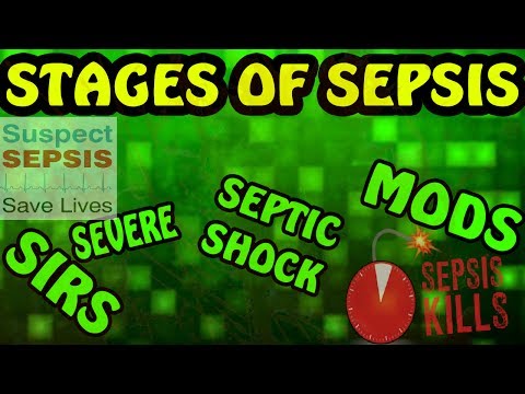 Stages of Sepsis (SIRS, Sepsis, Severe Sepsis, Septic Shock, MODS)