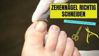 ZEHENNÄGEL RICHTIG SCHNEIDEN - So geht es richtig!