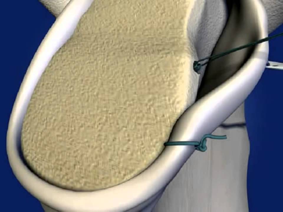 Roberto Postacchini-12